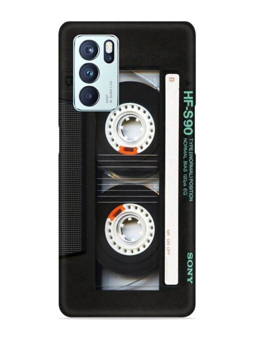 Sony Hf-S90 Cassette Snap Case for Oppo Reno 6 Pro (5G) Zapvi