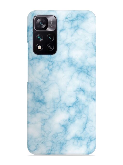 Blue White Natural Marble Snap Case for Xiaomi Mi 11I (5G)