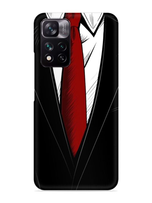 Mr. Professional Snap Case for Xiaomi Mi 11I (5G)