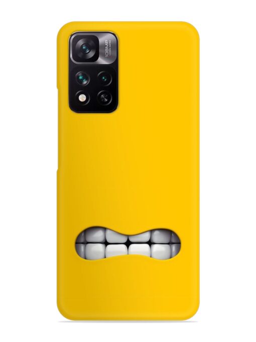 Mouth Character On Snap Case for Xiaomi Mi 11I (5G)