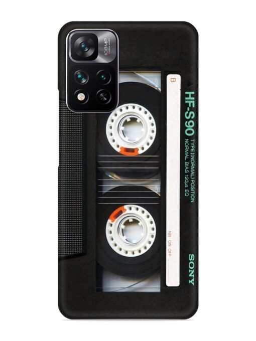 Sony Hf-S90 Cassette Snap Case for Xiaomi Mi 11I Hypercharge (5G)