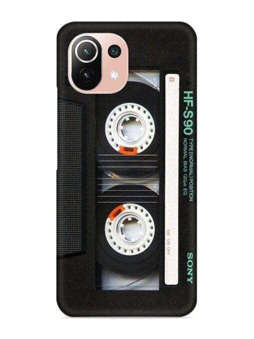 Sony Hf-S90 Cassette Snap Case for Xiaomi Mi 11 Lite Zapvi