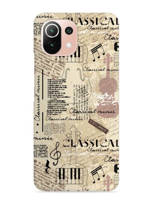 Classical Music Lpattern Snap Case for Xiaomi Mi 11 Lite Ne (5G) Zapvi