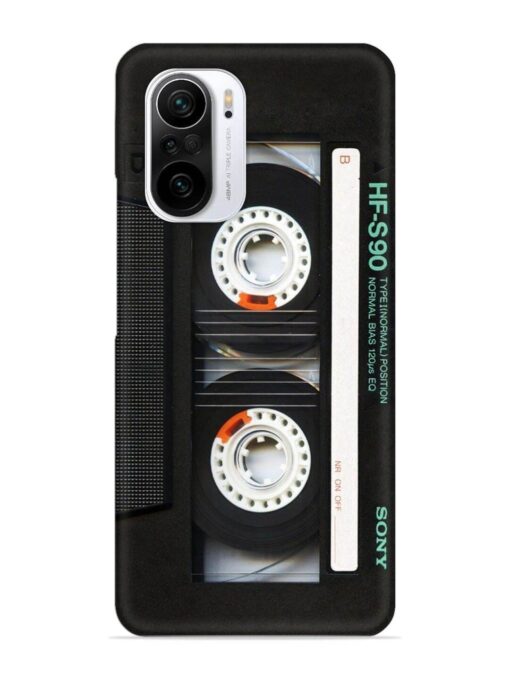 Sony Hf-S90 Cassette Snap Case for Xiaomi Mi 11X Pro (5G)