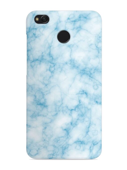 Blue White Natural Marble Snap Case for Xiaomi Redmi 4 Zapvi