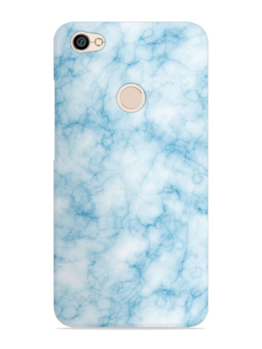 Blue White Natural Marble Snap Case for Xiaomi Redmi Y1