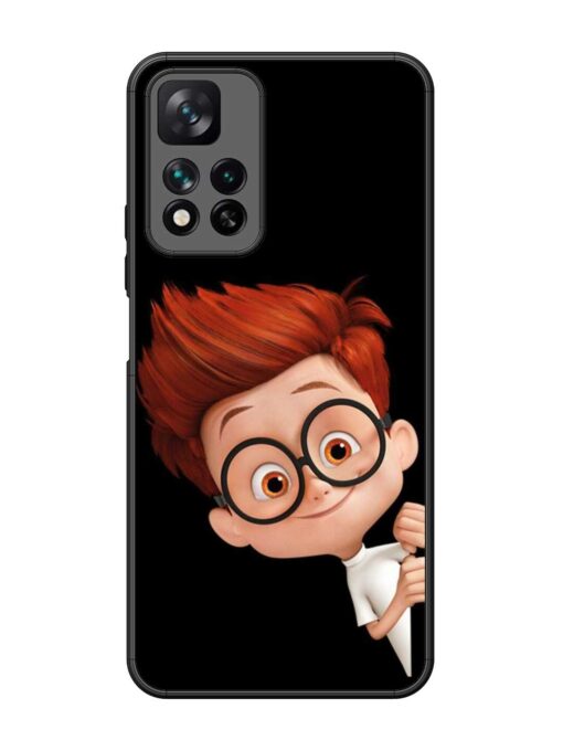 Smart Boy Cartoon Glossy Metal Phone Cover for Xiaomi Mi 11I Hypercharge (5G)