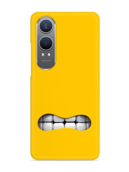 Mouth Character On Snap Case for Oneplus Nord Ce 4 Lite (5G)