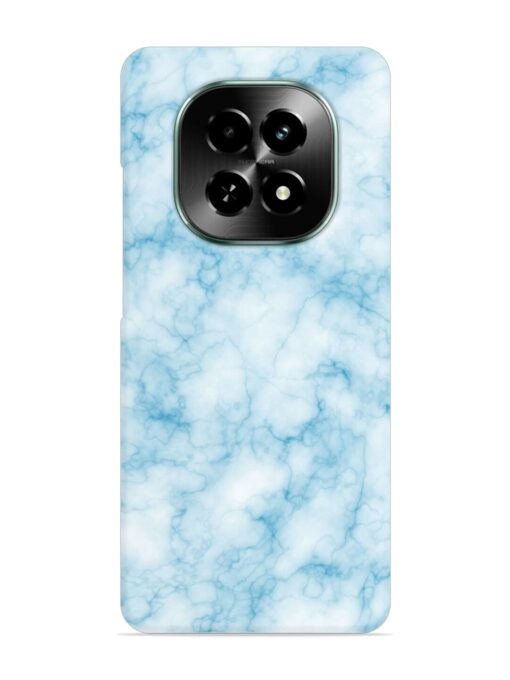 Blue White Natural Marble Snap Case for Realme C63 (5G)